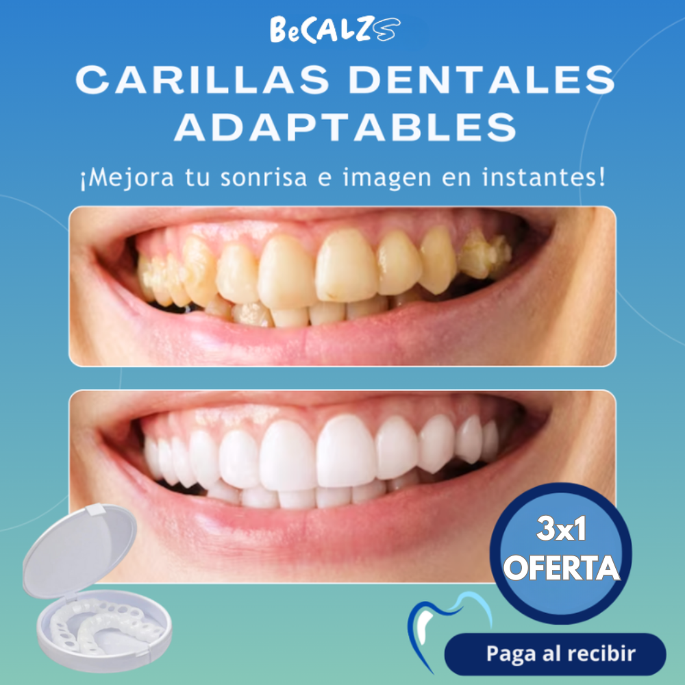 Carillas Dentales Adaptables - Transforma tu Sonrisa 😱OFERTA EXCLUSIVA 3X1😱
