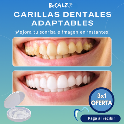 Carillas Dentales Adaptables - Transforma tu Sonrisa 😱OFERTA EXCLUSIVA 3X1😱